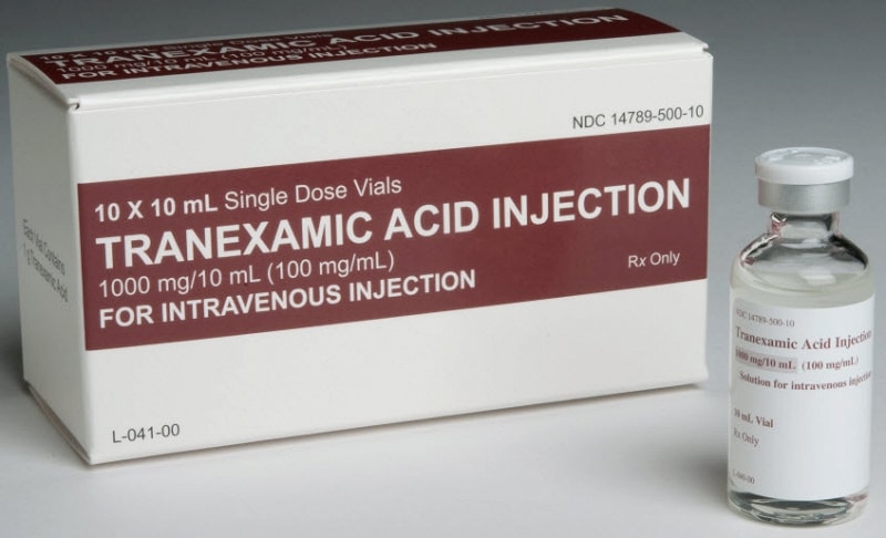 Axit Tranexamic giúp làm giảm triệu chứng u xơ tử cung